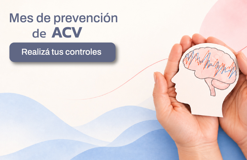 ACV