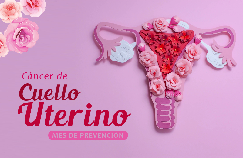 CÁNCER DE CUELLO UTERINO 
